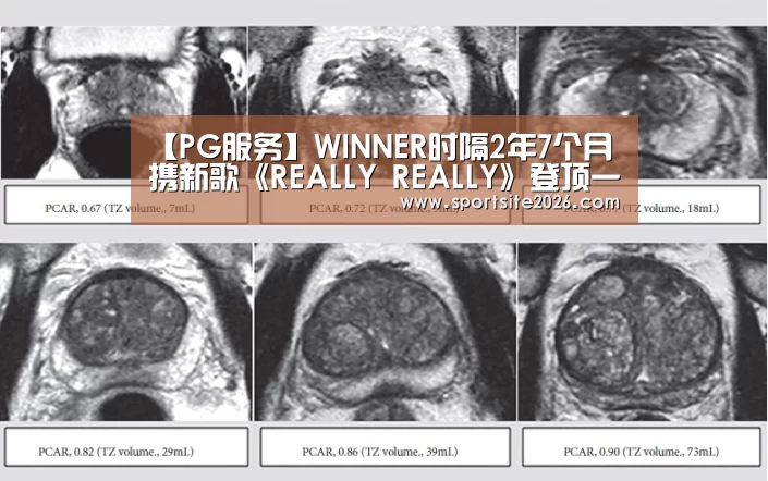 【PG服务】WINNER时隔2年7个月携新歌《REALLY REALLY》登顶一位(图2) PG直播